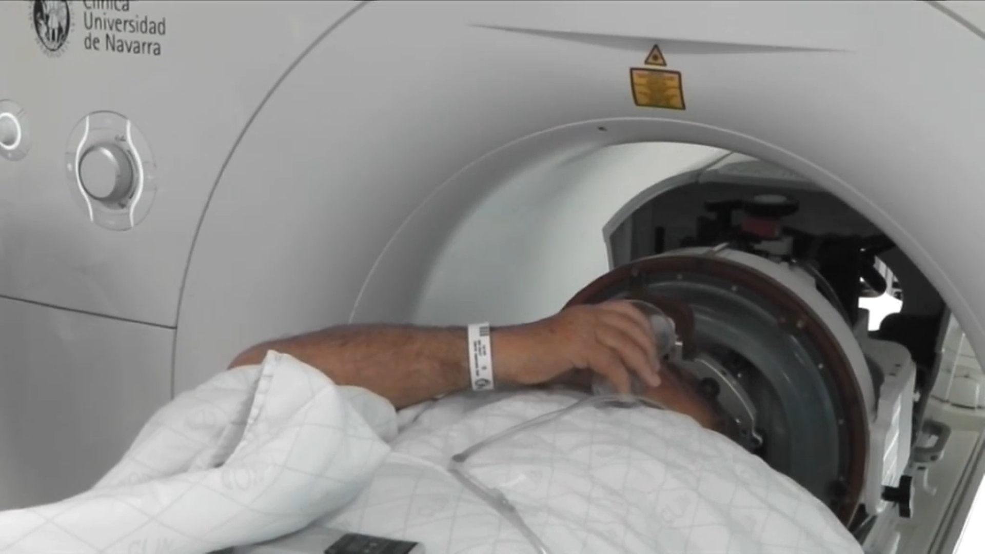 Cada vegada es detecten més pacients joves amb Parkinson